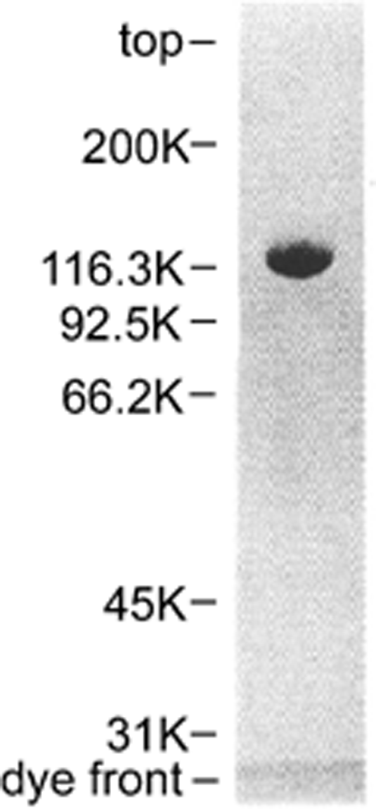 Sds+page+gel+protocol