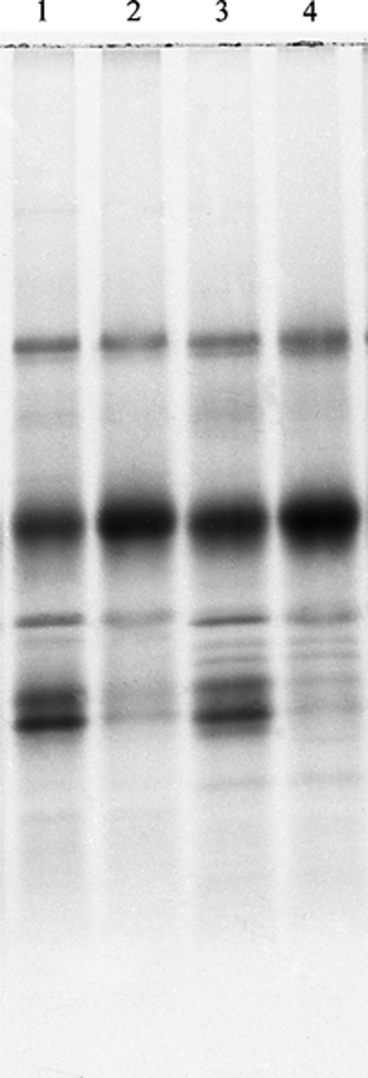 Sds+page+gel+troubleshooting