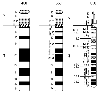 Chromosome 13 idiogram