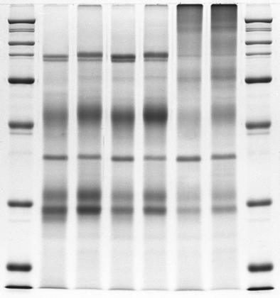 Sds+page+gel+troubleshooting