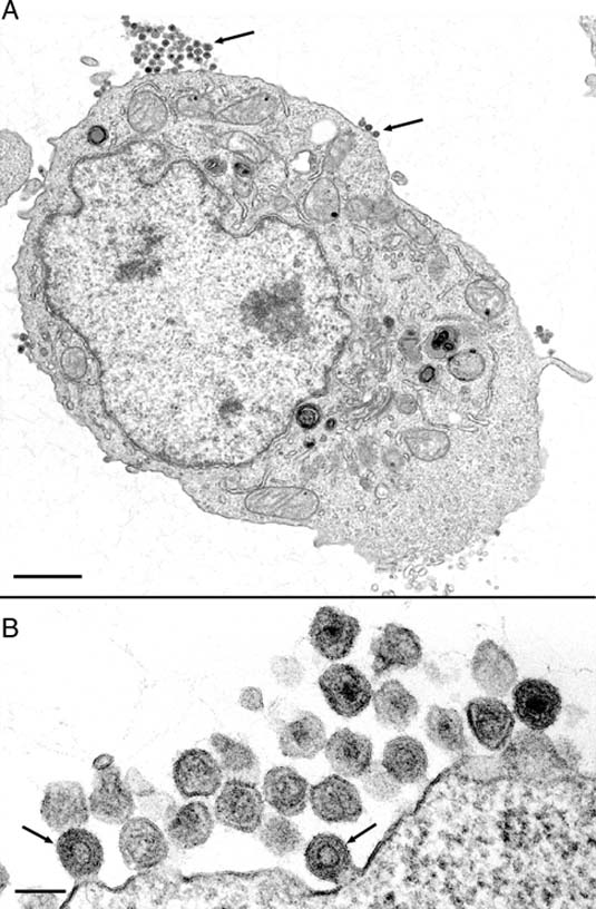 Transmission Electron Microscopy. Transmission electron