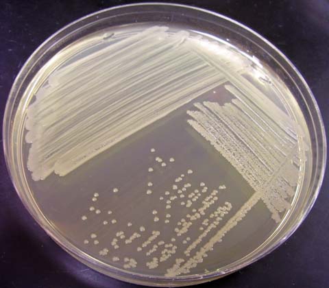 moraxella catarrhalis mannerism