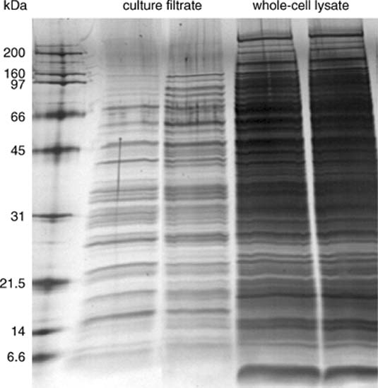 Sds+page+gel+protocol