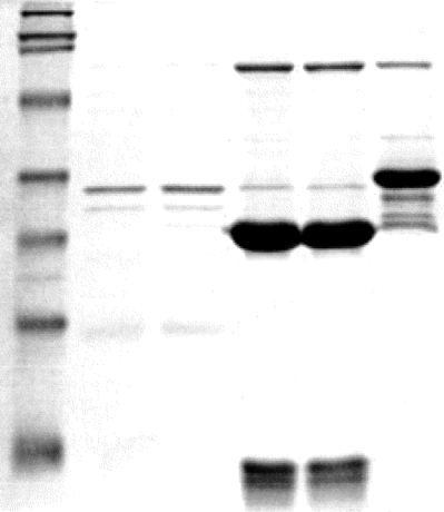 Sds+page+gel+protocol