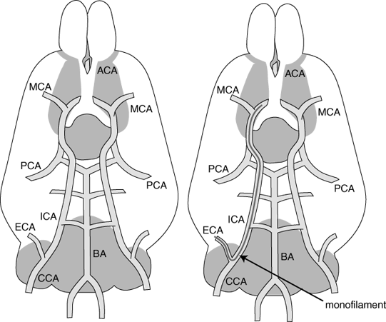 Posterior Cerebral Artery. Carotid and cerebral arteries