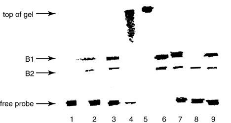 Dna+page+gel+electrophoresis