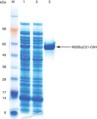 Sds+page+gel+troubleshooting