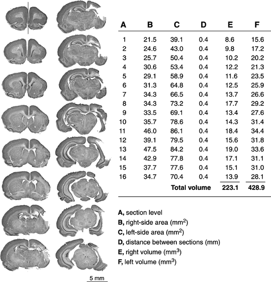 Sections Of The Brain. Coronal sections of the rain