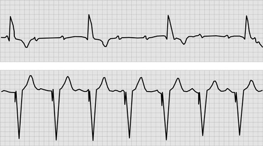 [Credit: ©1997–2010 Intermountain Healthcare. All rights reserve