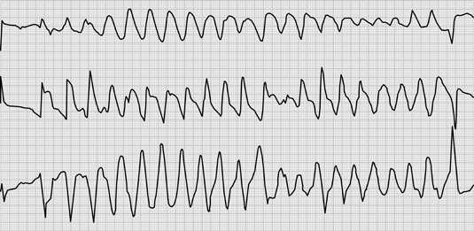 [Credit: ©2012 National Medical Slide Bank—Custom Medical Stock
