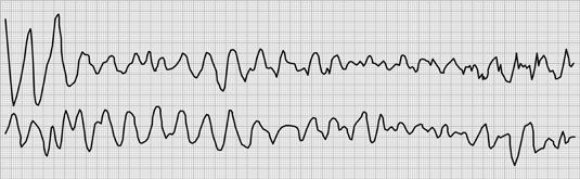 [Credit: ©1997–2010 Intermountain Healthcare. All rights reserve