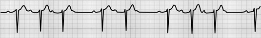 [Credit: ©1997–2010 Intermountain Healthcare. All rights reserve