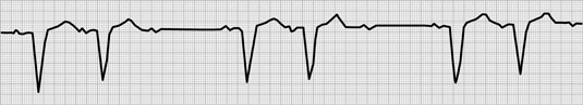 [Credit: ©1997–2010 Intermountain Healthcare. All rights reserve