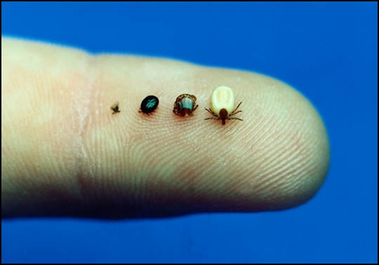 Body Bugs Pictures