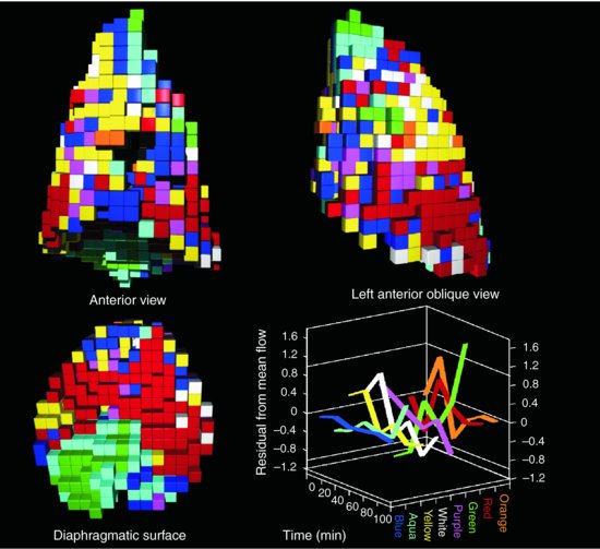 Lung Blood Flow