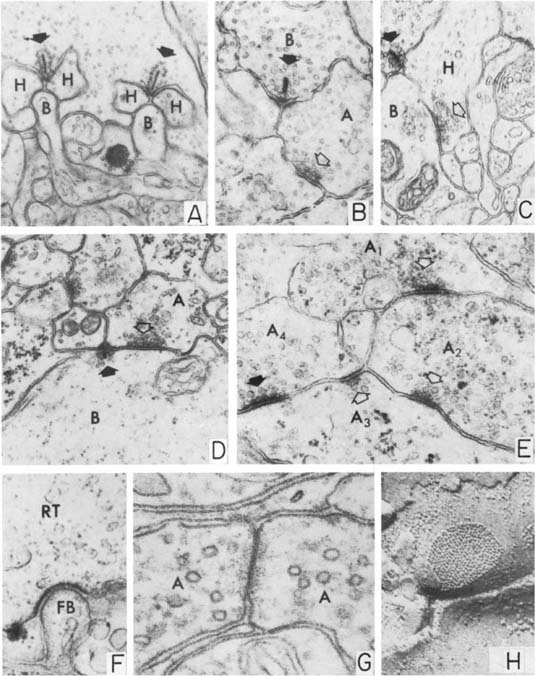 ribbon synapse