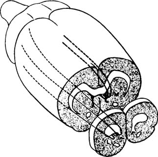 Dorsal Noradrenergic Bundle