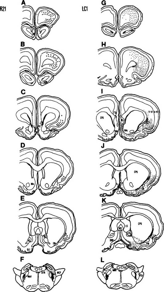 Right Cerebral Peduncle