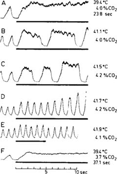 Inspiratory Ramp Signal