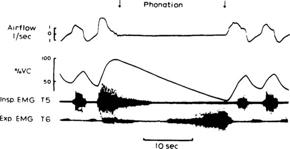 Spirogram Tracing