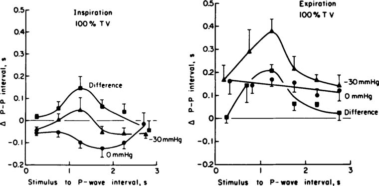 Baroreceptor Response