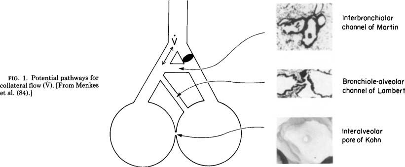 Collateral Ventilation