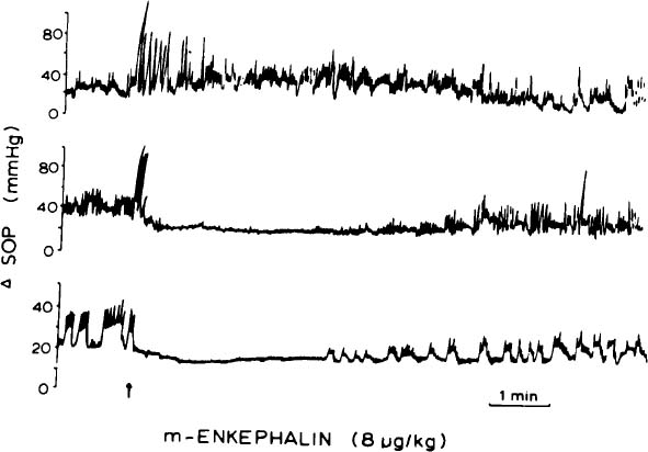 Sphincter Of Boyden