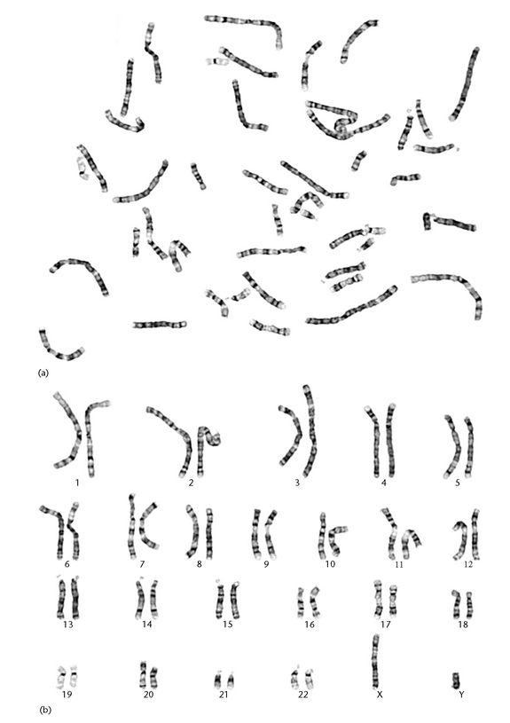 Metaphase Karyotype