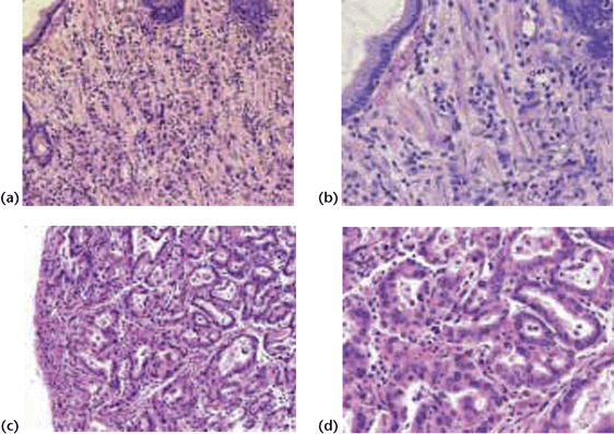 Gastric Histology