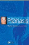 Handbook of Psoriasis, 2nd Edition (1405109270) cover image