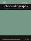 Echocardiography