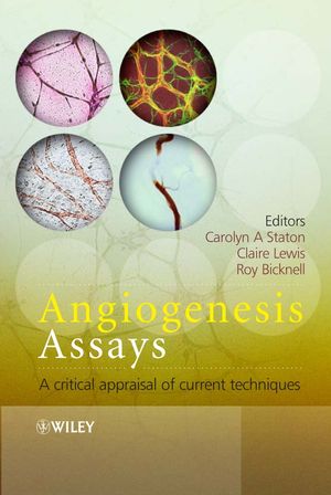 Angiogenesis Assays: A Critical Appraisal of Current Techniques (0470016000) cover image