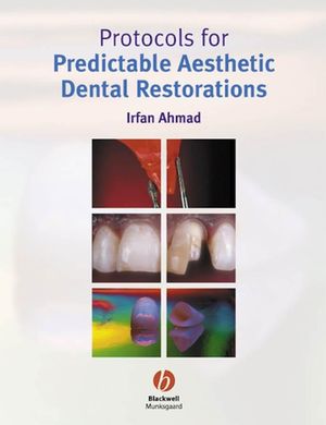 Protocols for Predictable Aesthetic Dental Restorations (1405118202) cover image
