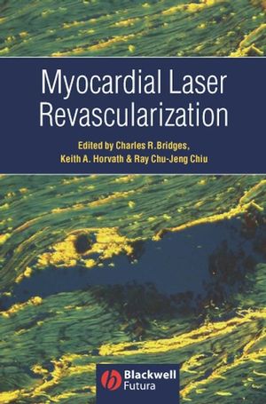 Myocardial Laser Revascularization (1405122102) cover image