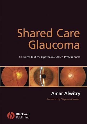 Shared Care Glaucoma (1405168005) cover image