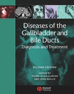 Diseases of the Gallbladder and Bile Ducts: Diagnosis and Treatment, 2nd Edition (1405127406) cover image