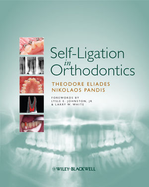 Self-Ligation in Orthodontics (1405181907) cover image