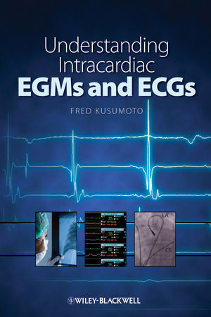 Understanding Intracardiac EGMs and ECGs (1405184108) cover image