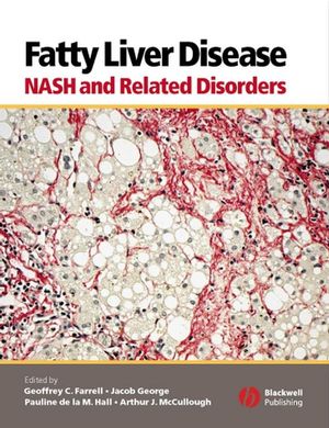 Fatty Liver Disease: NASH and Related Disorders (140514100X) cover image