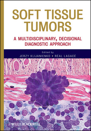 Soft Tissue Tumors: A Multidisciplinary, Decisional Diagnostic Approach (0470505710) cover image
