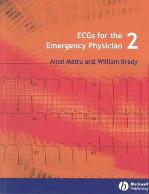 ECGs for the Emergency Physician 2 (1405157011) cover image