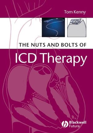 The Nuts and Bolts of ICD Therapy (1405135115) cover image