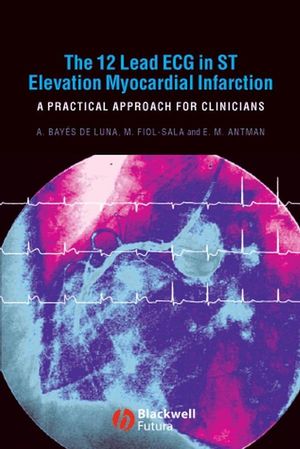 The 12 Lead ECG in ST Elevation Myocardial Infarction: A Practical Approach for Clinicians (1405173416) cover image