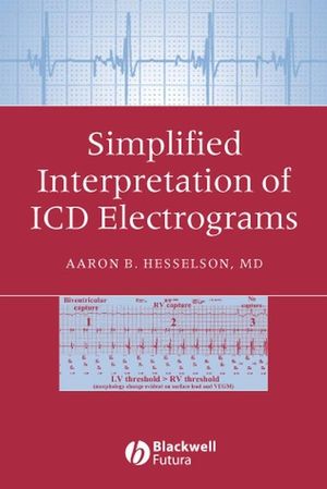 Simplified Interpretation of ICD Electrograms (1405127317) cover image