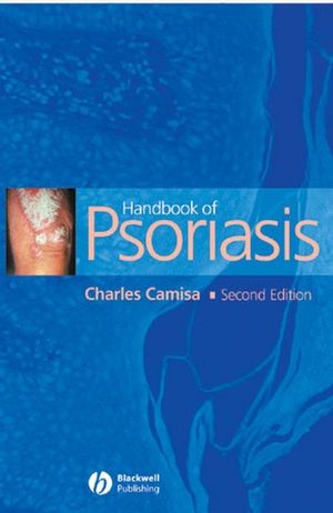 Handbook of Psoriasis, 2nd Edition (1405146117) cover image