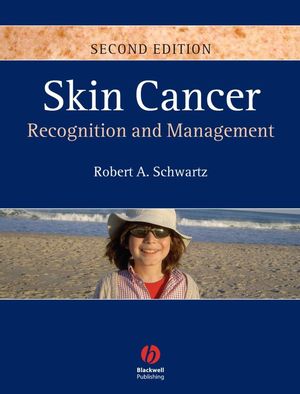 Skin Cancer: Recognition and Management, 2nd Edition (1405159618) cover image