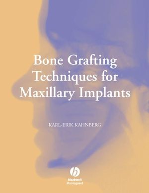 Bone Grafting Techniques for Maxillary Implants (1405171618) cover image