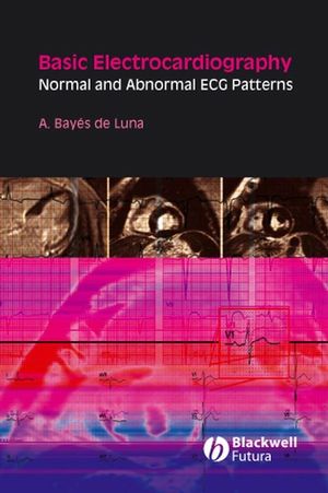 Basic Electrocardiography: Normal and Abnormal ECG Patterns (0470691719) cover image