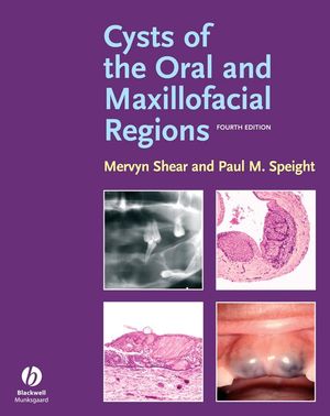 Cysts of the Oral and Maxillofacial Regions, 4th Edition (0470759720) cover image