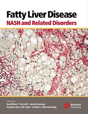 Fatty Liver Disease: NASH and Related Disorders (1405112921) cover image
